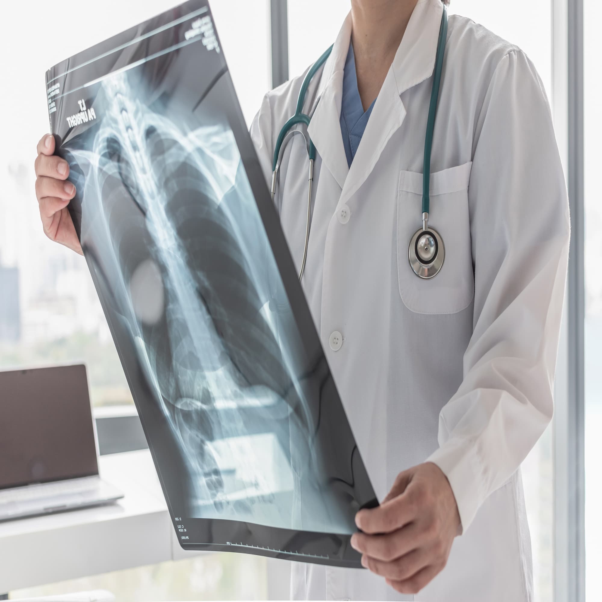 Médico revisando una radiografía con un paciente